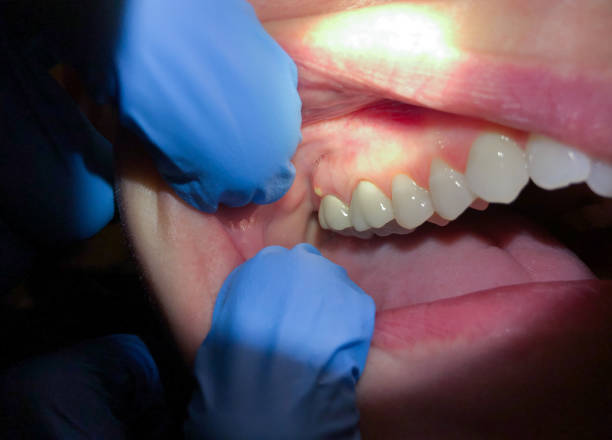 Best Urgent Care for Lost Fillings or Crowns in Erie, KS