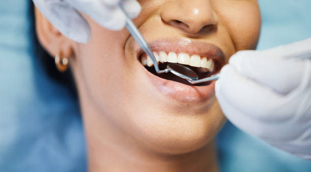 Best Emergency Gum Treatment in Erie, KS