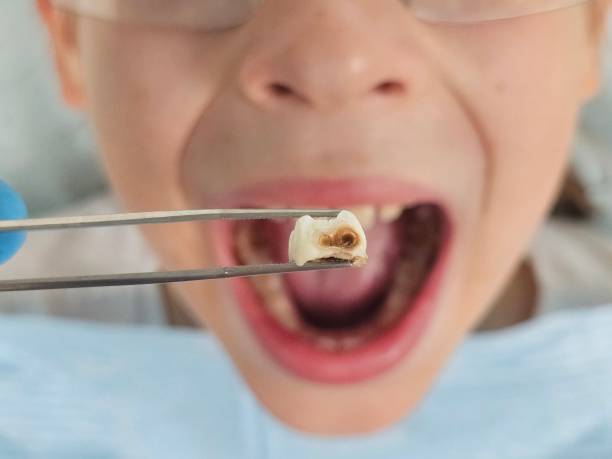 Best Emergency Denture Repair in Erie, KS